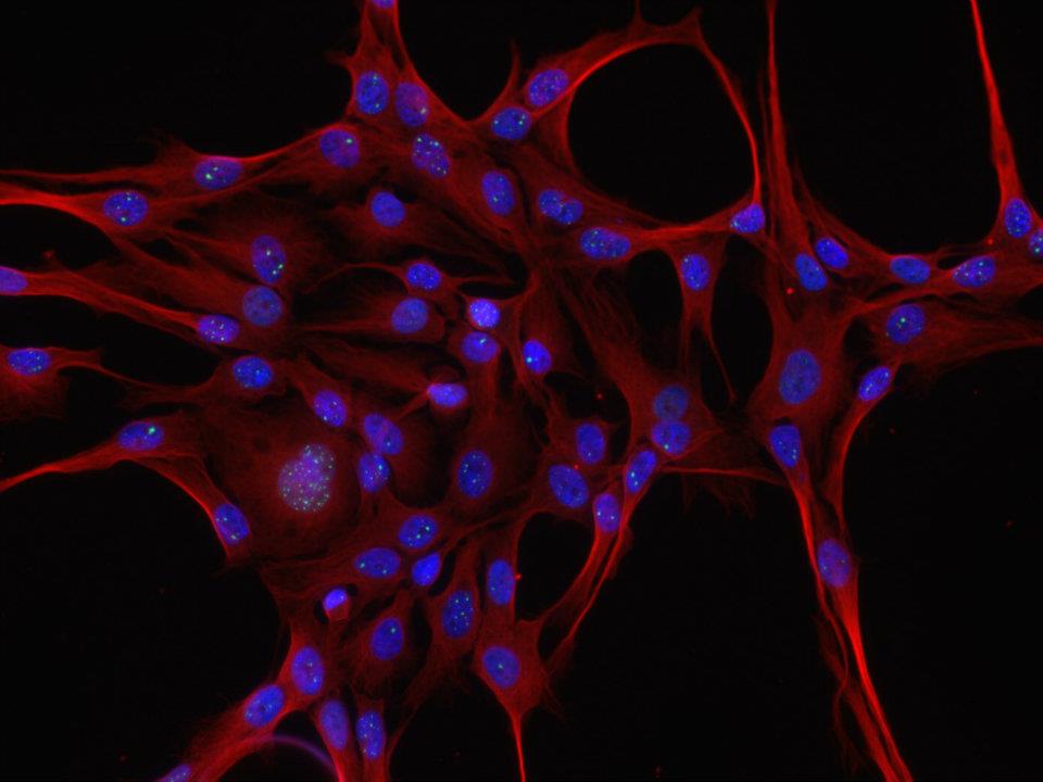 Microscopic photo of neuron cells