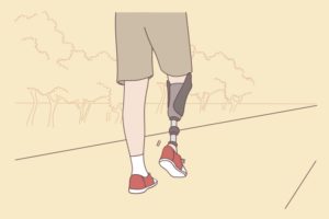 Man walking with prosthetic leg